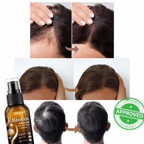 crescimento capilar  biotina  biotina capilar  deluxe hair  deluxehair  ellegancedeluxe  deluxe  crescer cabelo  crescer barba  cabelo crescimento